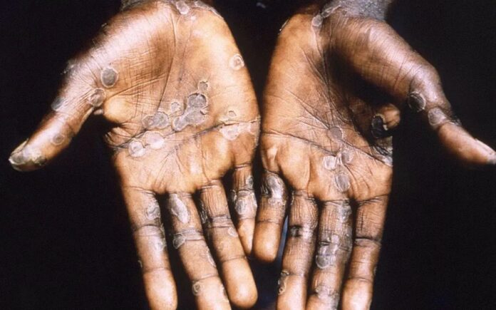 WhatsApp Image 2022-05-27 at 7.31.54 AM